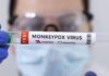 belgica primer país que impone cuarentena por viruela